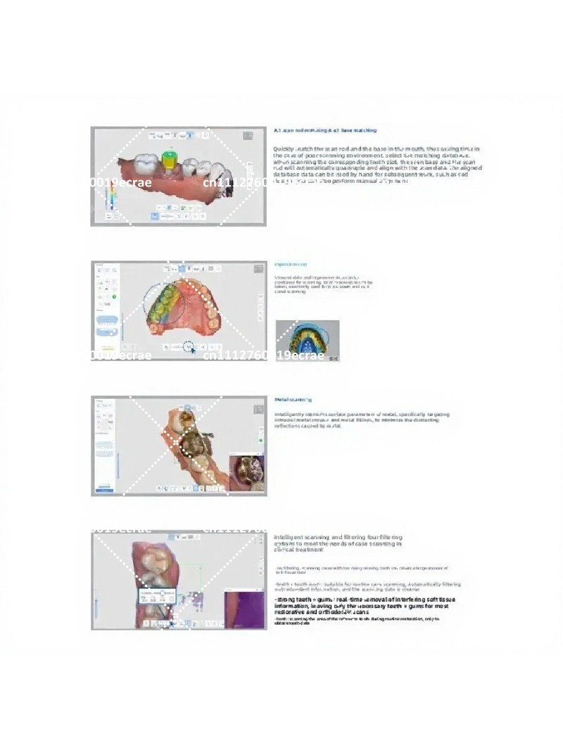 High-Quality Intraoral Scanner - Outdoor Furniture Quality recension och pris